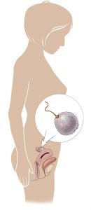 Gebeliğin 2 haftası Gebeliğin 2 haftası