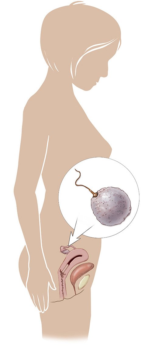 Gebeliğin 2 haftası