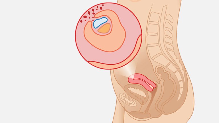 Gebeliğin 4 haftası