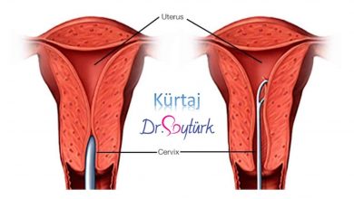 Kürtaj