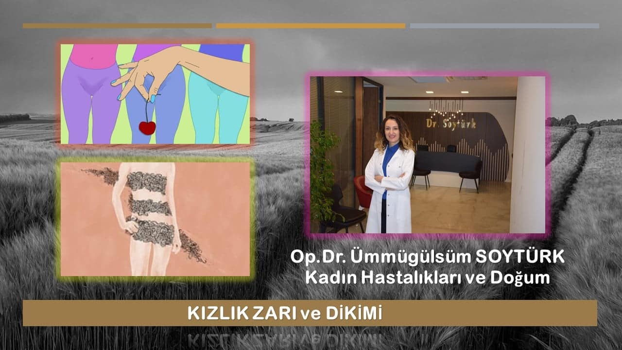 Kızlık Zarı ve Dikimi