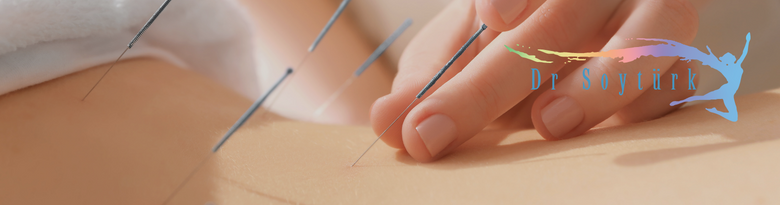 Akupunktur Nedir
